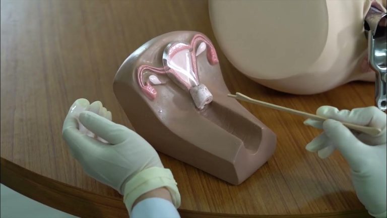 PEMERIKSAAN PAP SMEAR